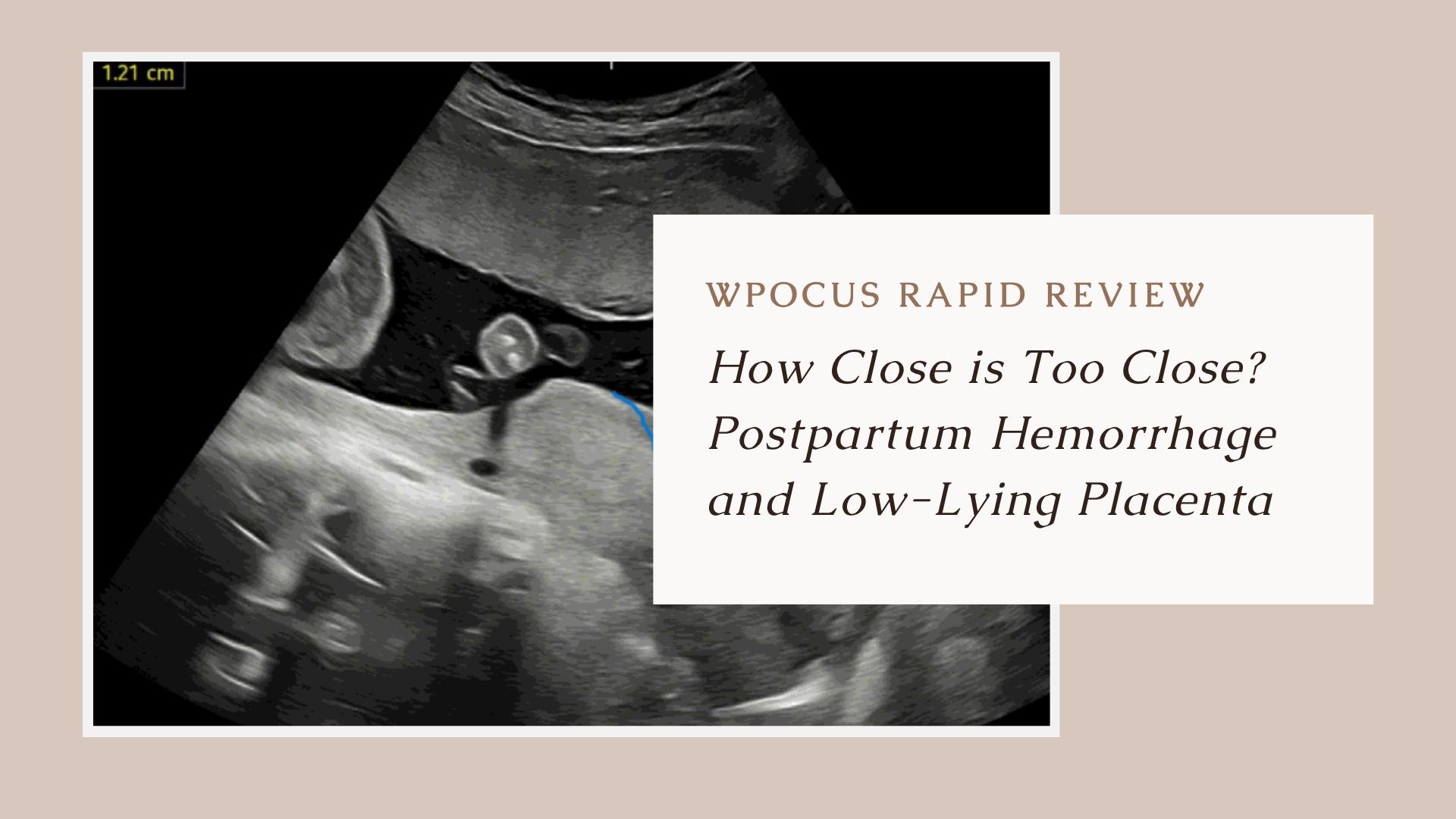 How Close is Too Close? Postpartum Hemorrhage and Low-lying Placenta